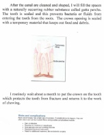 root canal 3_20160613_0001.pdf