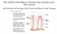 root canal 1_20160613_0001.pdf